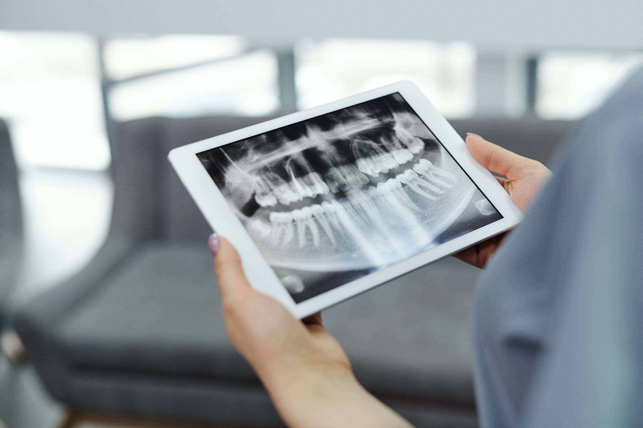 Digital radiography